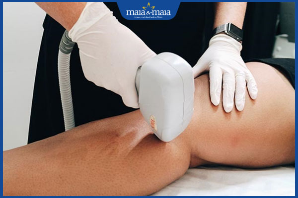 Gợi ý 4 cách tẩy lông chân cho nam đơn giản tại nhà 5 triệt lông chân ở nam