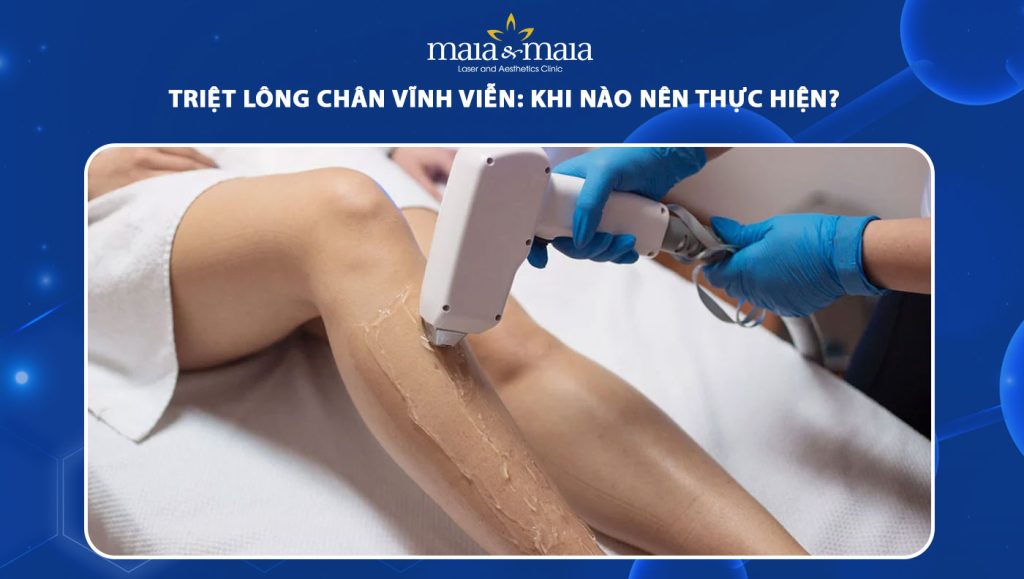 Triệt lông chân vĩnh viễn: Mẹo cho làn da mịn màng, sạch sẽ 1 triệt lông chân vĩnh viễn