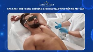 triệt lông cho nam giới