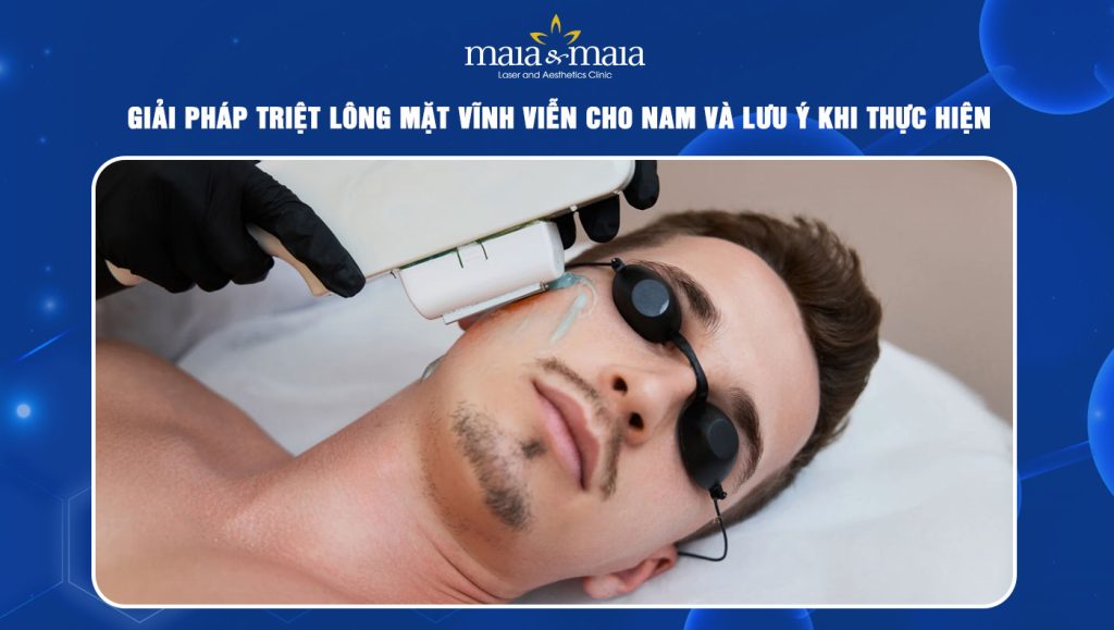 triệt lông mặt vĩnh viễn cho nam