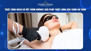 triệt lông nách có hết thâm không