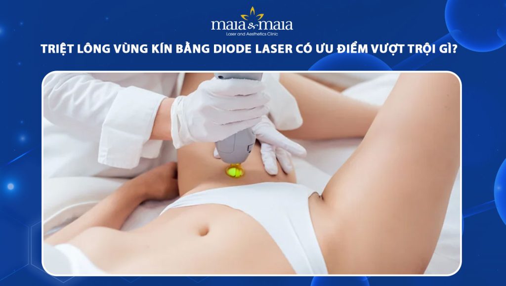 Triệt lông vùng kín bằng Diode Laser có ưu điểm gì? 1 triệt lông vùng kín bằng diode laser