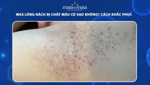 wax lông nách bị chảy máu