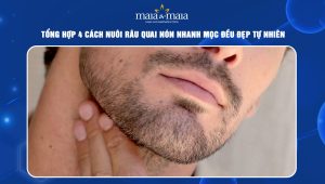 Cách nuôi râu quai nón