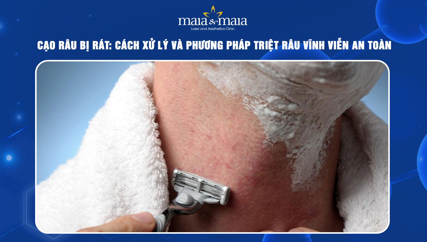 Cạo râu bị rát: Cách xử lý và giải pháp triệt râu vĩnh viễn