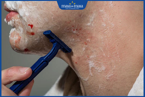 cạo râu sai cách