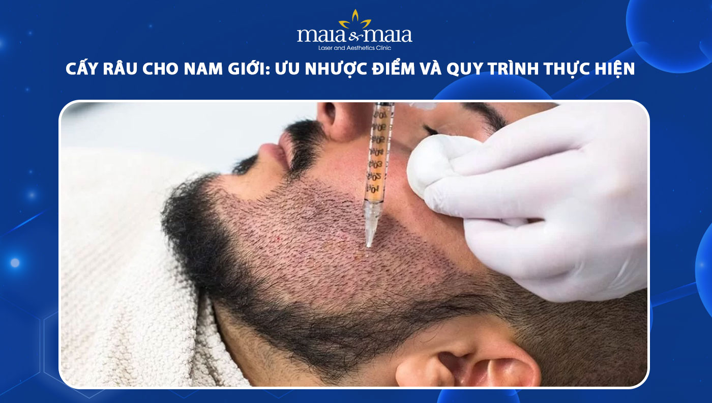 Cấy râu cho nam giới: Ưu nhược điểm và quy trình thực hiện