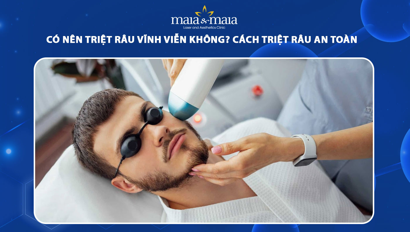 Có nên triệt râu vĩnh viễn không? Cách triệt râu an toàn