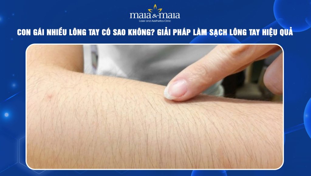 Con gái nhiều lông tay