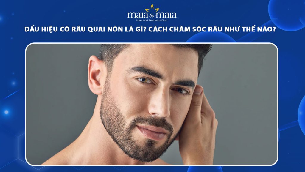 dấu hiệu có râu quai nón