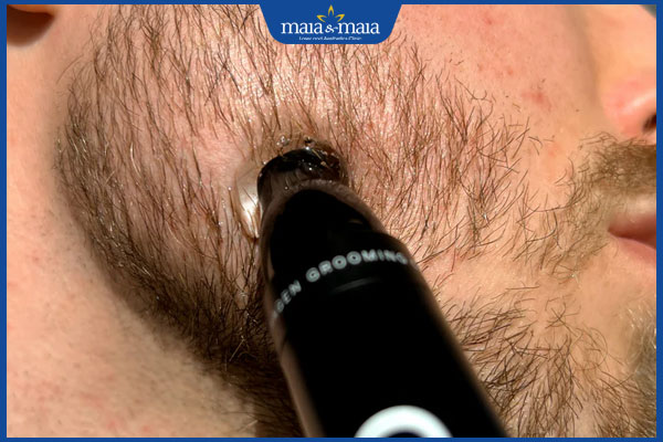 dùng sản phẩm kích thích mọc râu