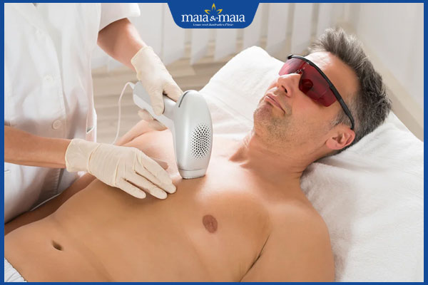 ipl triệt lông ngực