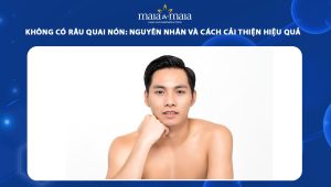 không có râu quai nón