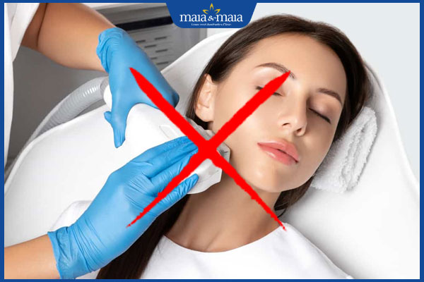 không được triệt lông