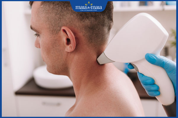 kỹ thuật triệt lông gáy