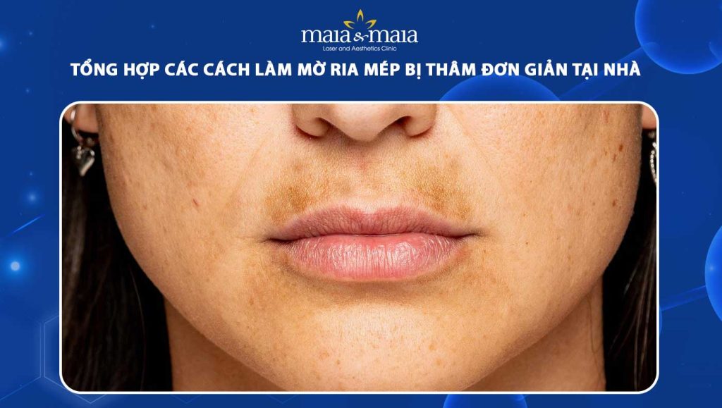 làm mờ ria mép bị thâm