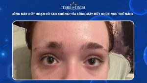 lông mày đứt đoạn