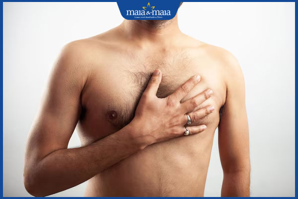 lông ngực gây mất thẩm mỹ