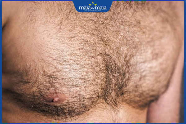 lông ngực rậm