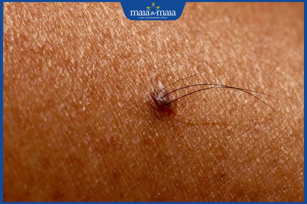 lông tài ở chân