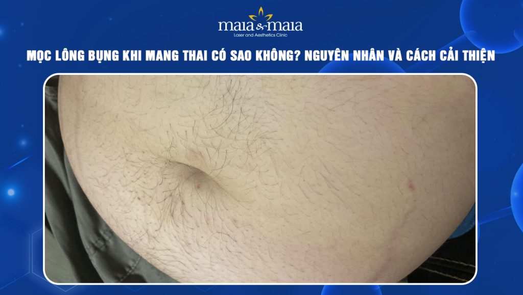 Mọc lông bụng khi mang thai có sao không? Cách cải thiện 1 mọc lông bụng khi mang thai