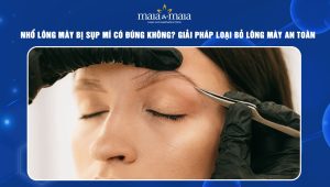 nhổ lông mày bị sụp mí