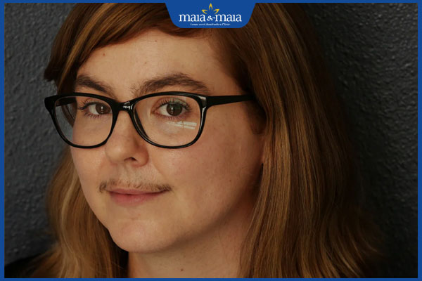 nữ giới mọc râu