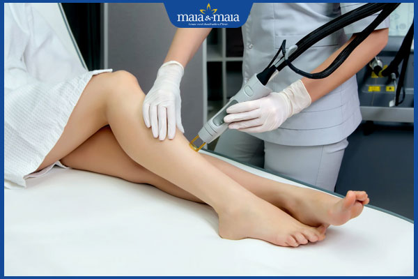 Triệt lông bằng điện phân: Quy trình, hiệu quả và chi phí 3 quá trình triệt lông bằng điện phân