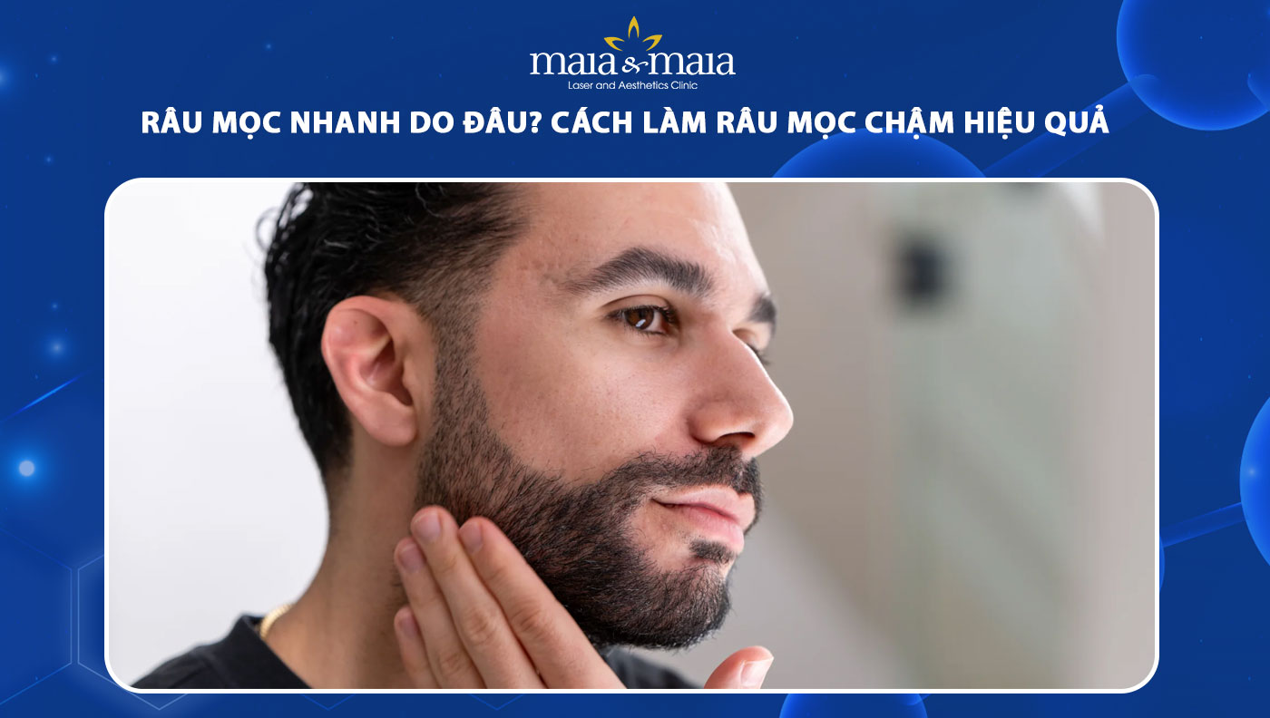 Râu mọc nhanh do đâu? Cách làm trậm quá trình mọc râu