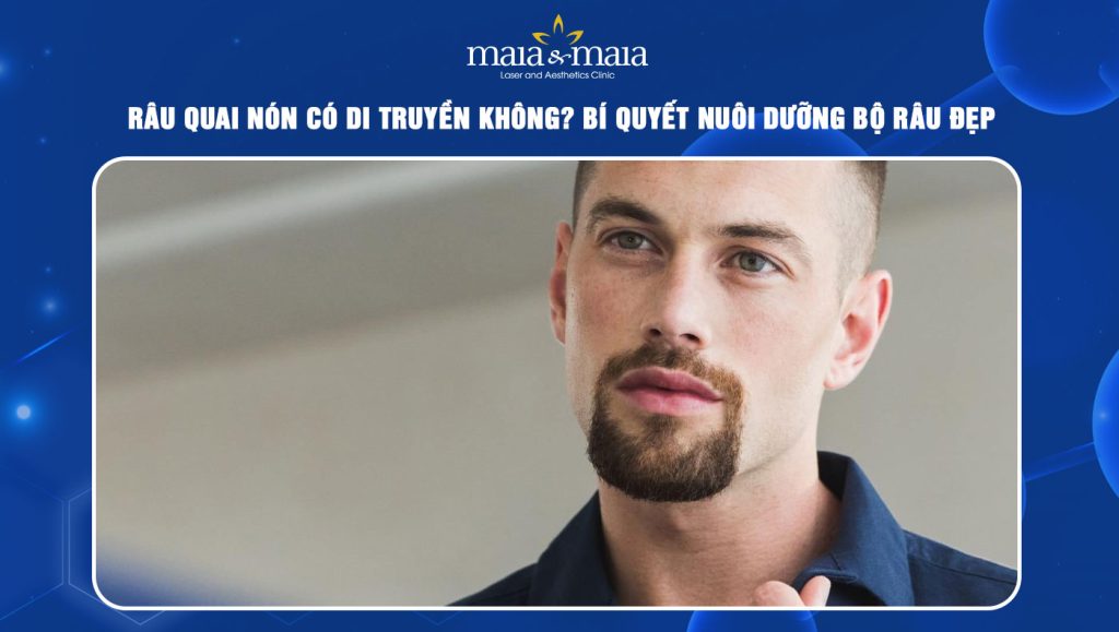 râu quai nón có di truyền không