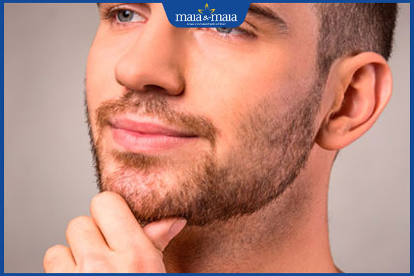 râu quai nón ở đàn ông