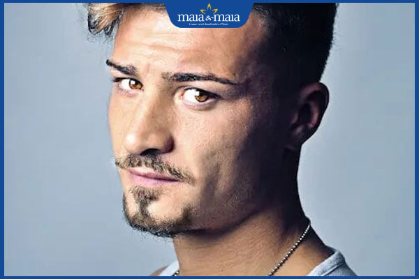 râu ria mép kiểu mỏ neo