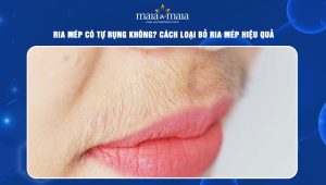 ria mép có tự rụng không