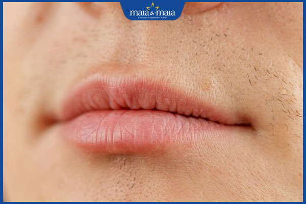 Tẩy ria mép bằng đường có hiệu quả không? 4 cách thực hiện 5 ria mép mọc lại