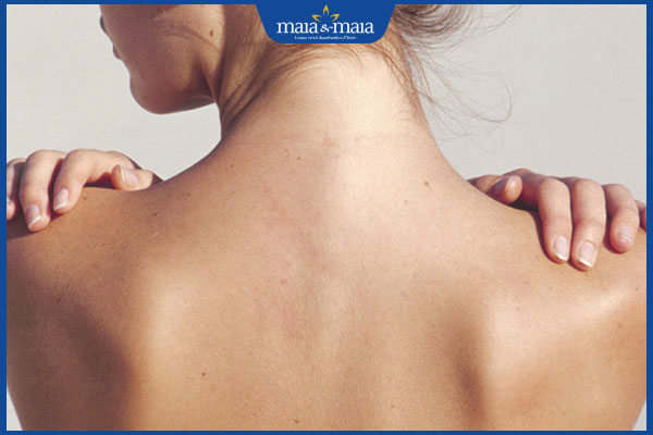 Triệt lông lưng: Quy trình, chi phí và địa chỉ thực hiện 2 sau triệt lông lưng