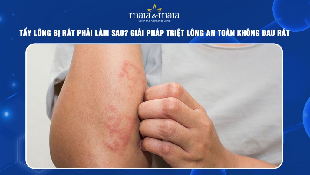 Tẩy lông bị rát phải làm sao? Giải pháp triệt lông an toàn 1 tẩy lông bị rát