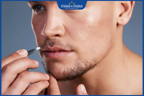 thực hiện nhổ râu