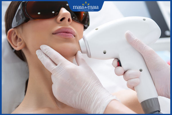 thực hiện triệt ria mép