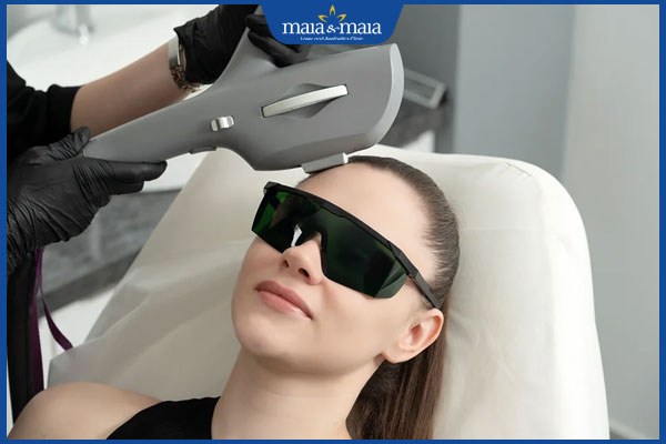 thực hiện triệt viền chân tóc