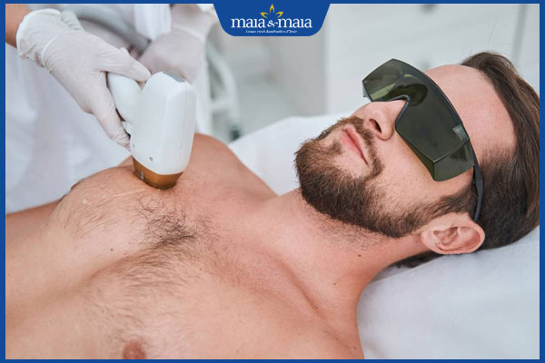 tiến hành triệt lông ngực