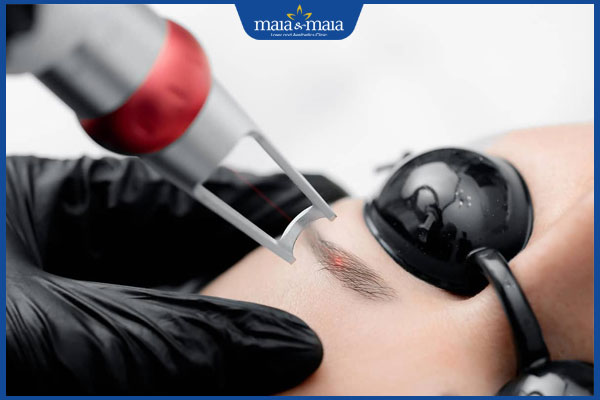 triệt 1 phần lông mày