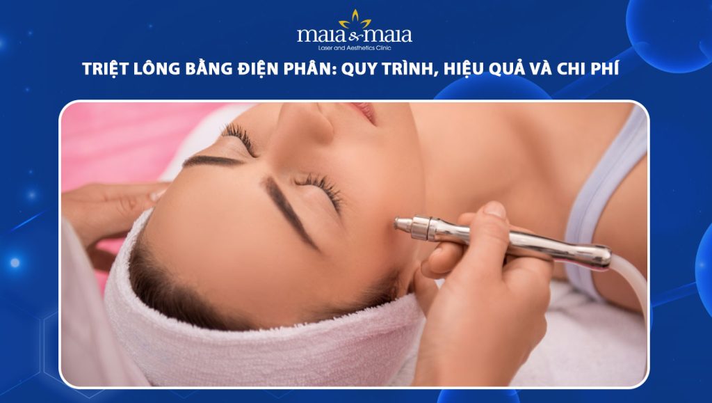 Triệt lông bằng điện phân: Quy trình, hiệu quả và chi phí 1 triệt lông bằng điện phân