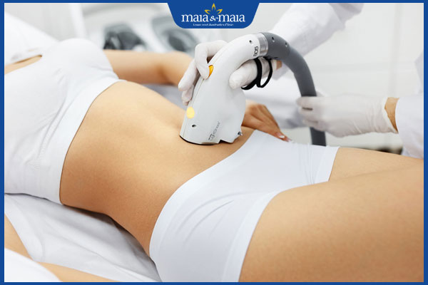 triệt lông bụng bằng công nghệ cao