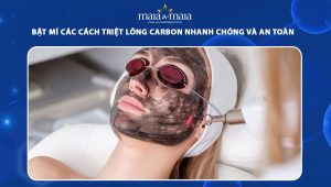 triệt lông carbon