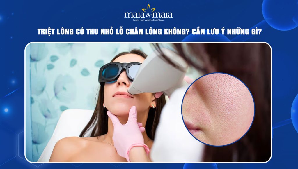 Triệt lông có thu nhỏ lỗ chân lông không