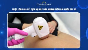 Triệt lông giá rẻ