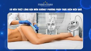 Triệt lông hậu môn