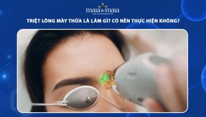 triệt lông mày thừa
