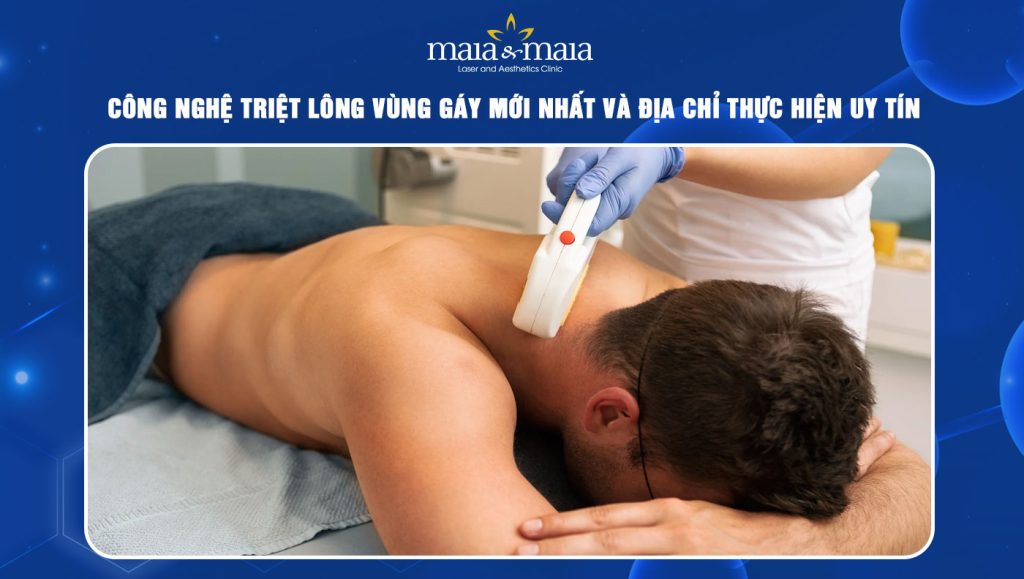 Triệt lông vùng gáy