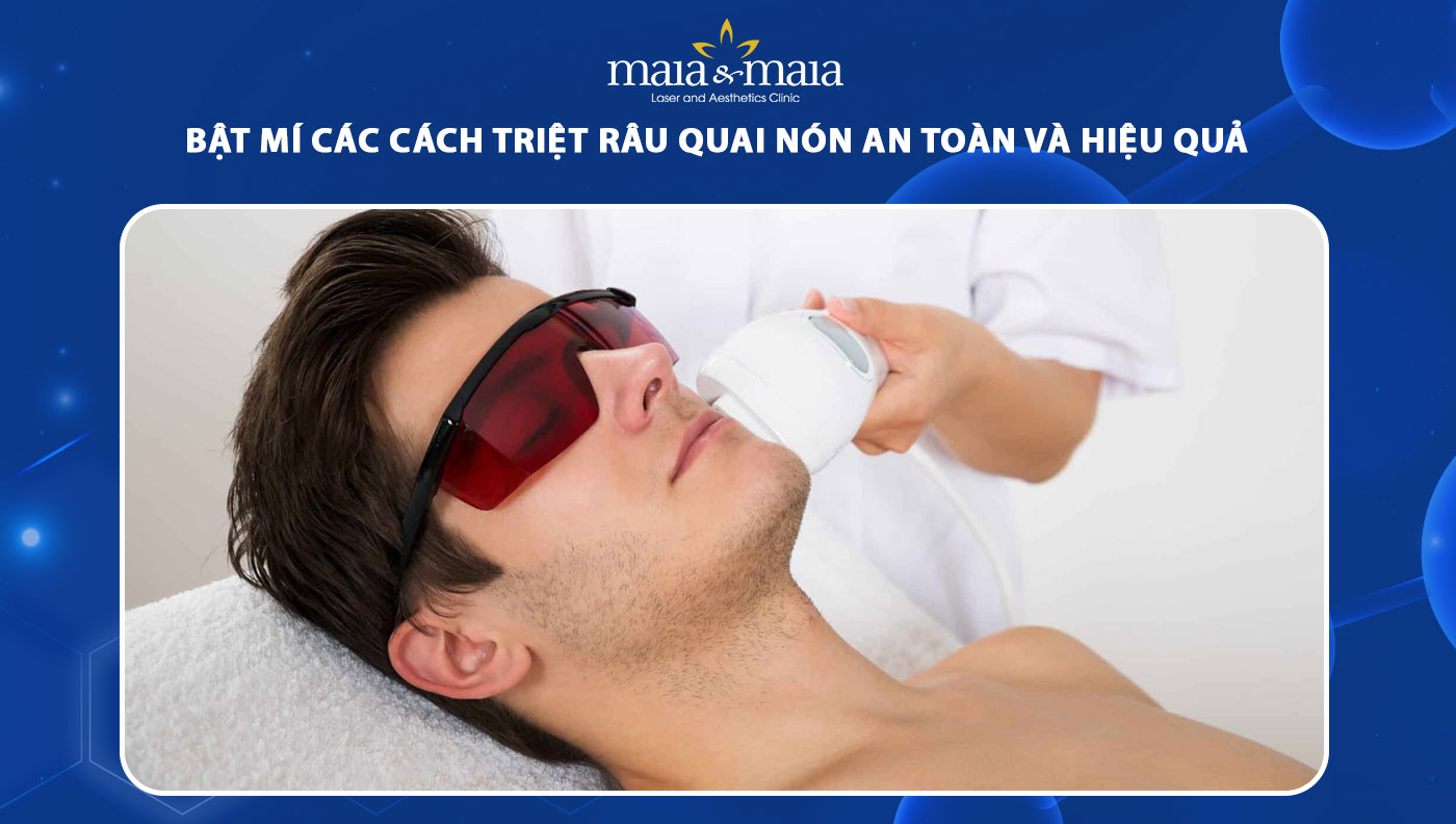 Bật mí các cách triệt râu quai nón an toàn và hiệu quả